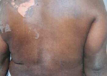 From Victim to Accused: The Twisted Battle for Justice on Mbeya Island